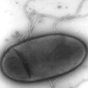 Бактерия с "Титаника" берёт начало в давних пробах, поднятых со дна океана (фото Henrietta Mann).