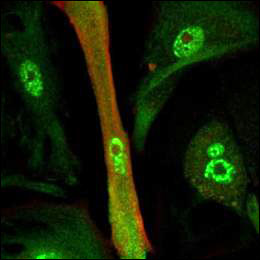 Кардиомиоцит (в центе) демонстрирует распределение белков (зеленого и красного цвета), характерное для молодых кардиомиоцитов.