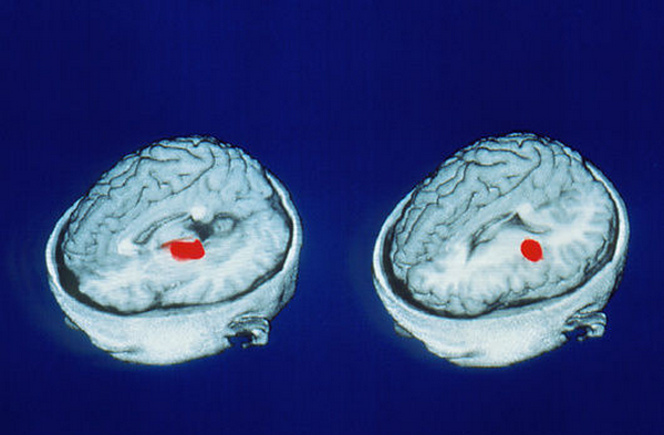 p3350030-pet_brain_scans_showing_accurate_memory_of_words-spl.png