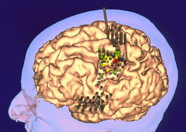 p3350050-functional_map_of_the_brain_s_motor_cortex_areas-spl.png