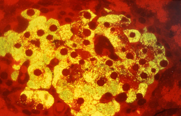p5400009-lm_of_beta_cells_from_islet_of_langerhans-spl.png