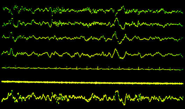 m8720124-sleep_research_various_traces_of_stage_2_sleep-spl.png