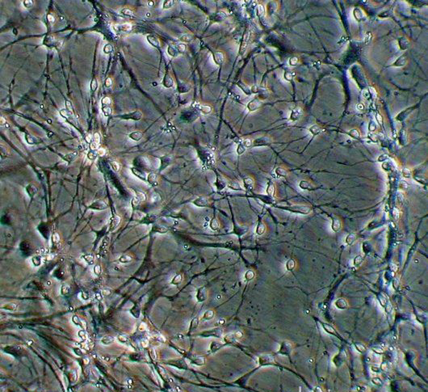 c0103076-brain_cells_light_micrograph-spl.png