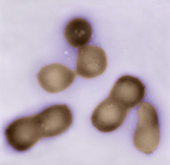 mycoplasma-mycoides.jpg