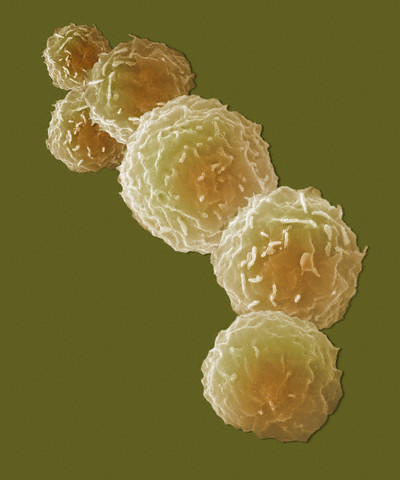 nkj-stvolovye-cells-2.jpg