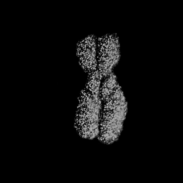 nkj-x-hromosome-1.jpg