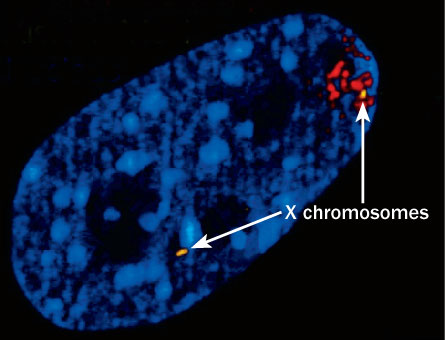 nkj-x-hromosome-2.jpg