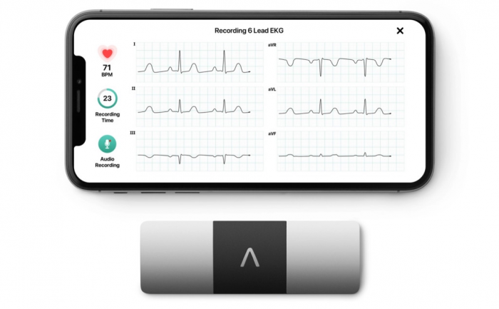 ekg1.png