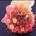 Как выживают метастазирующие опухолевые клетки