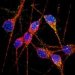 Нейроны из индуцированных плюрипотентных стволовых клеток помогут понять причины болезни Альцгеймера