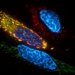 Установлен ключевой белок клеточной смерти