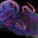 Как и зачем биологи вырастили «в пробирке» миниатюрный человеческий мозг?