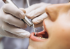 В Японии испытают первое в мире лекарство, восстанавливающее рост зубов