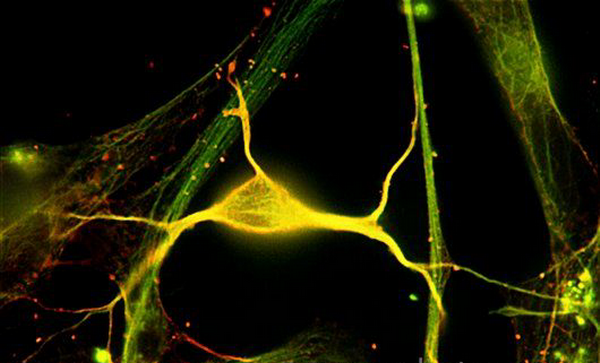 c0074021-hippocampal_neuron_fluorescent_micrograph-spl.png