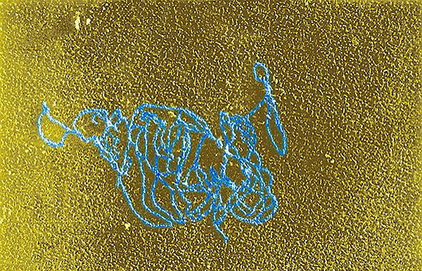 g110922-dna_and_e._coli_rna_polymerase_reaction-spl.jpg