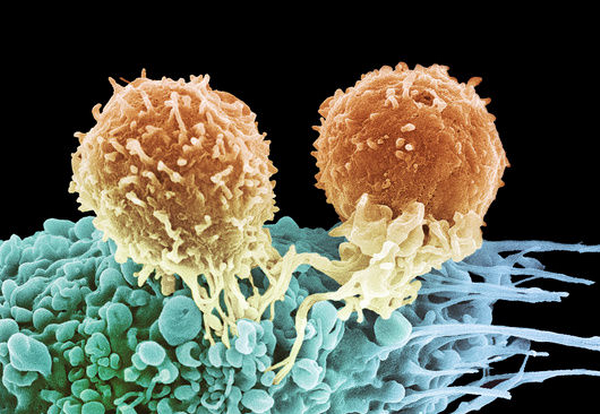 m1320895-t_lymphocytes_and_cancer_cell_sem-spl.png