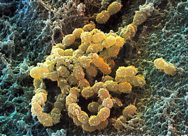 b2360126-streptococcus_mutans_bacteria_sem-spl.png