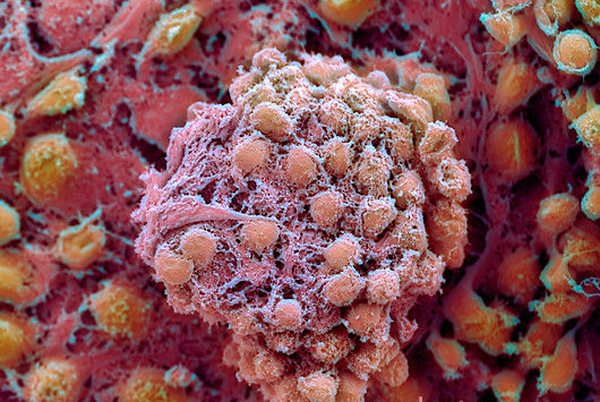 g4420228-embryonic_stem_cells_sem-spl.png