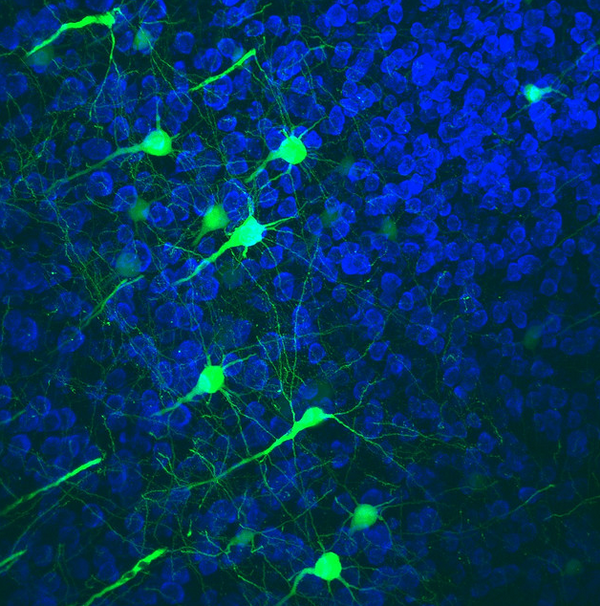 Скорость нейронов в мозге. Нейроны мозга. Тормозующие Нейроны. Веретенообразные Нейроны фото.