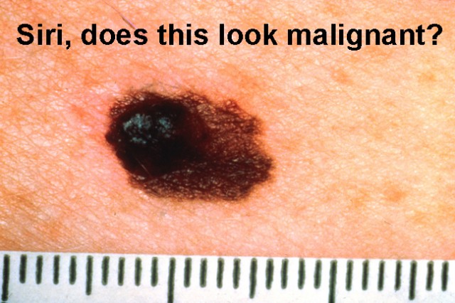 geektimes-melanoma-2.jpg