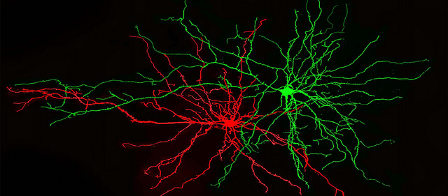 nkj-neurons-for-strah-2.jpg