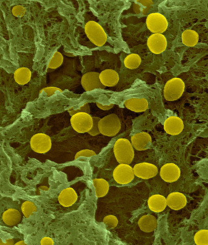 nkj-acidobacterium-1.jpg