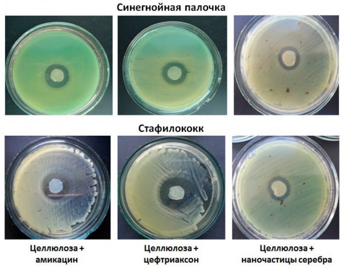 antibakterialnye-diski-podavlyayut-rost-patogennyh-mikroorganizmov-768x598.jpg
