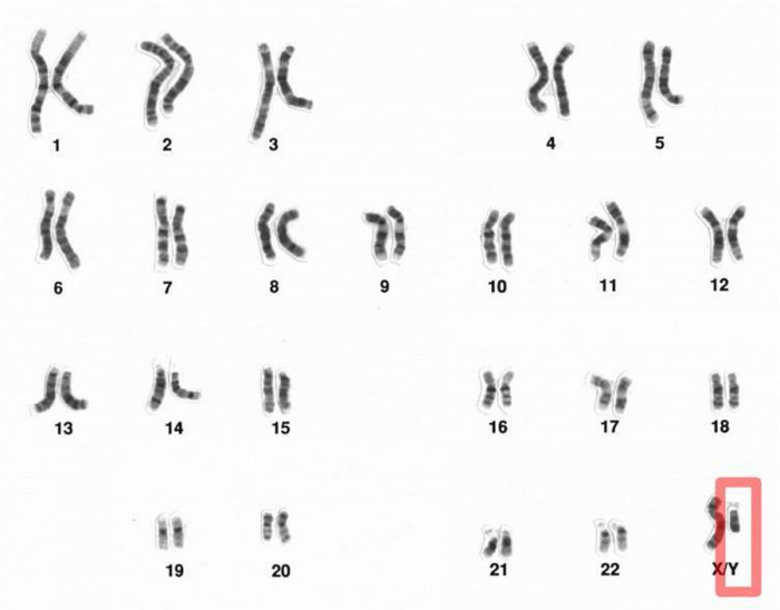 hromosoma1.png